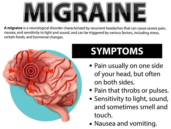 Plakat Informacyjny Ilustracji Migreny — Wektor stockowy