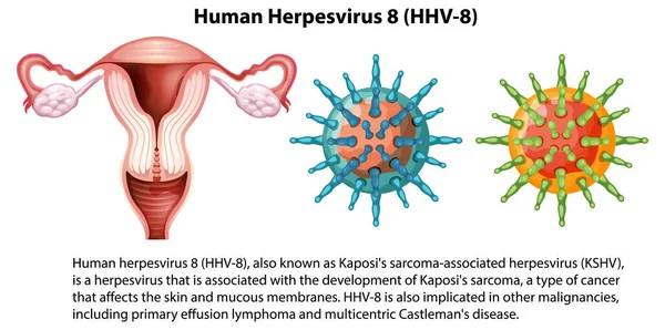 Illustratie Van Humaan Herpesvirus Hhv — Stockvector