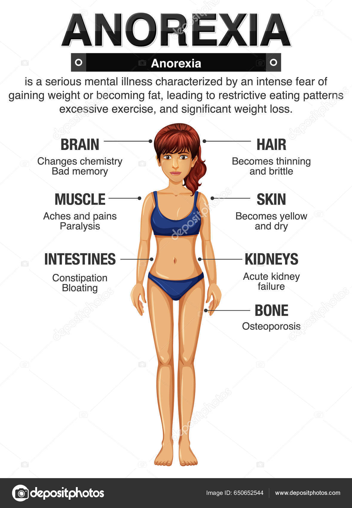 Anorexia Anorexia Seus Efeitos Ilustração Corpo Vetor de ©blueringmedia  650652544, image size:1178x1700