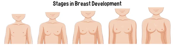 Stages Breast Development Illustration — Stock Vector