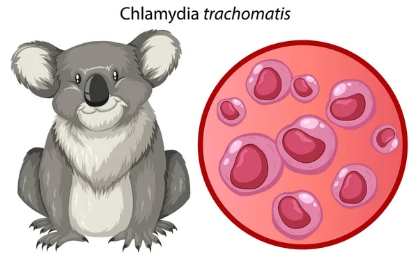 Chlamydia Trachomatis Met Uitleg Illustratie — Stockvector