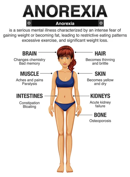 Anorexia Anorexia Sus Efectos Cuerpo Ilustración — Archivo Imágenes Vectoriales