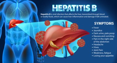 Hepatit B Infographic illüstrasyonunun belirtileri