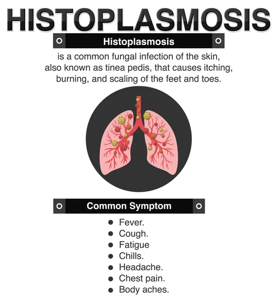 Cartaz Informativo Ilustração Histoplasmose — Vetor de Stock