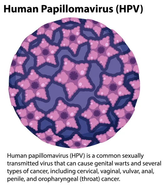 Human Papillomavirus Explanation Illustration — Vetor de Stock