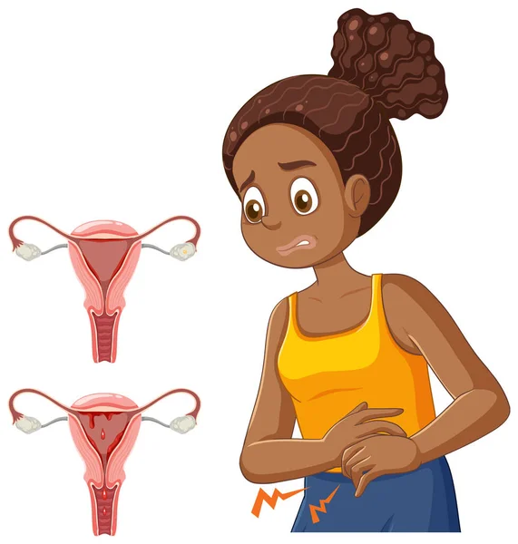 Fille Afro Américaine Éprouvant Des Crampes Menstruelles Pendant Puberté Illustration — Image vectorielle