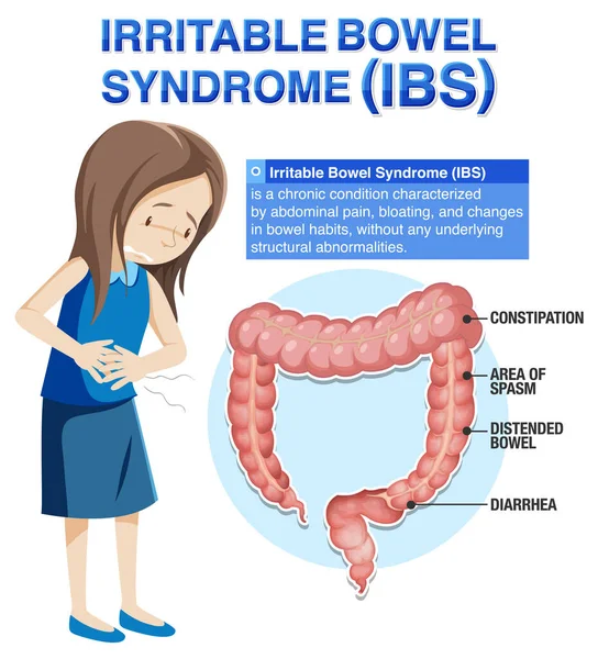 Infografická Ilustrace Syndromu Dráždivého Tračníku Ibs — Stockový vektor