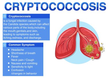 Cryptococcosis illüstrasyonunun bilgilendirici posteri