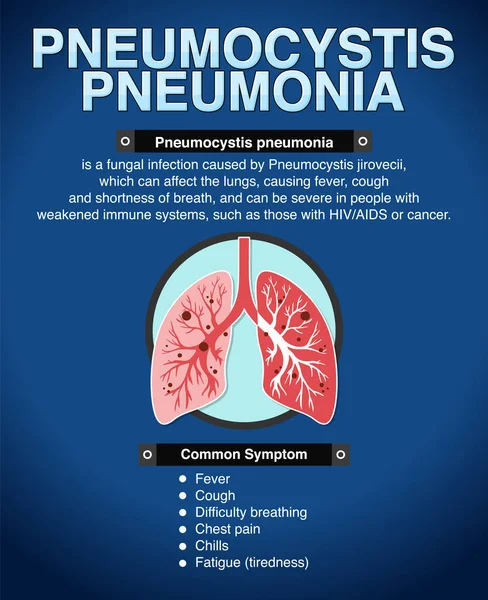 Cartaz Informativo Ilustração Pneumocystis Pneumonia — Vetor de Stock