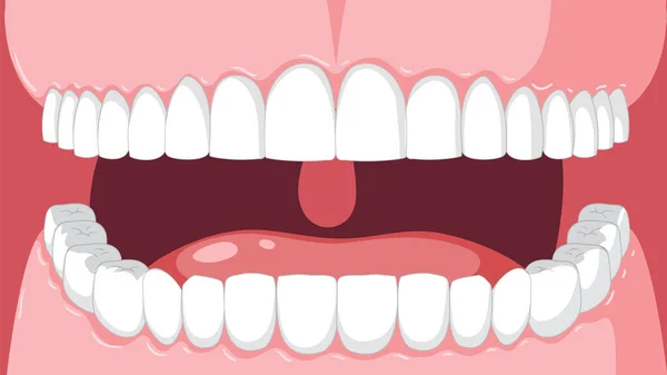 Mänskliga Tänder Närbild Tecknad Illustration — Stock vektor