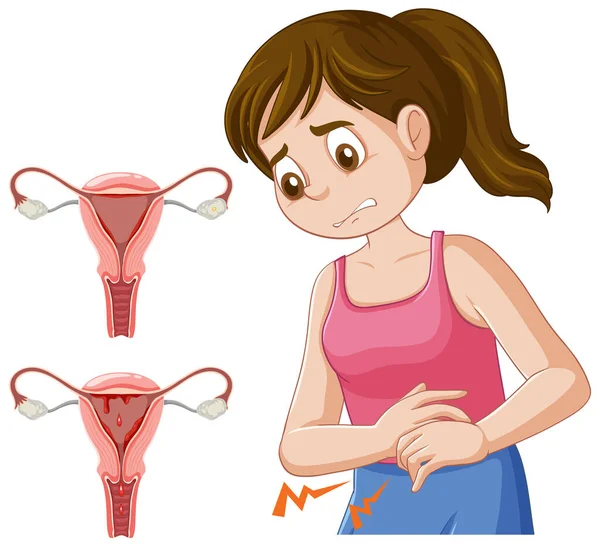 Informace Stádiích Ilustrace Menstruačního Cyklu — Stockový vektor