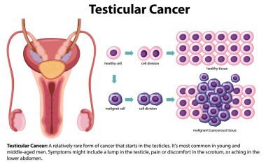 Erkek anatomisini testis kanseri olarak tasvir eden bir resim.