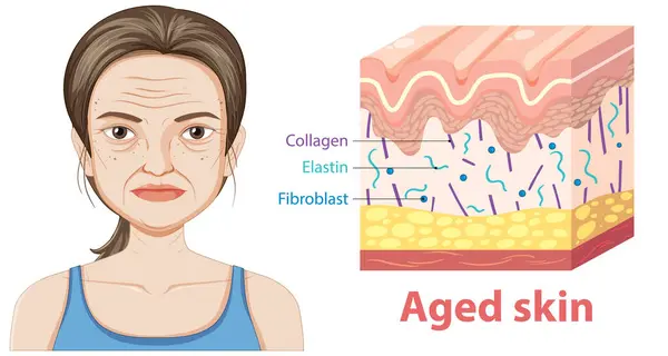 stock vector Illustration showing aged skin structure and components