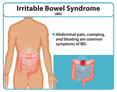 IBS belirtilerinin ve etkilenen bölgelerin gösterimi