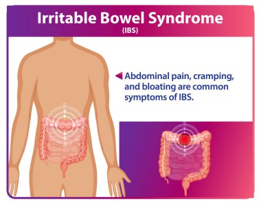 IBS belirtilerinin ve etkilenen bölgelerin gösterimi