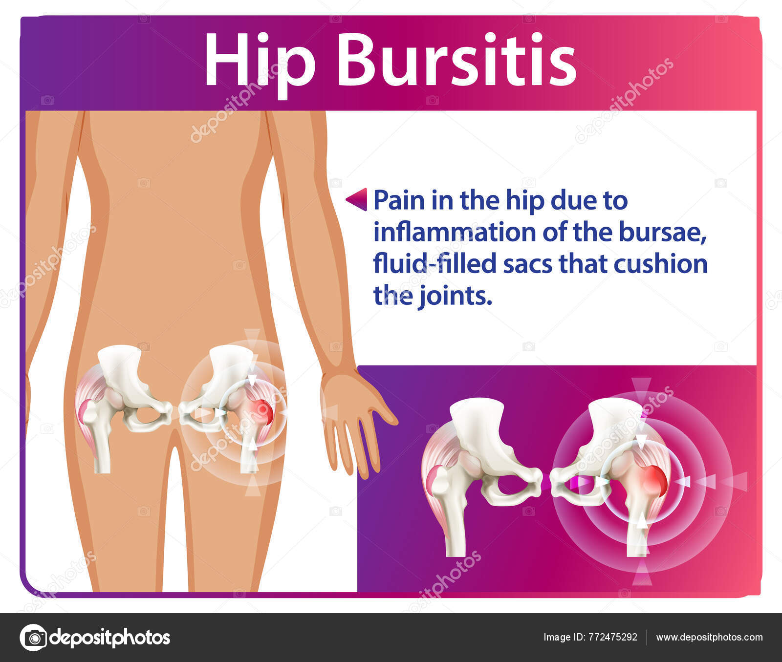 9.6: Anatomía de las articulaciones sinoviales seleccionadas - LibreTexts  Español, image size:1600x1355