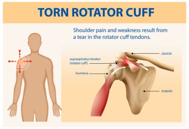Omuz anatomisi ve yaralanma detayları
