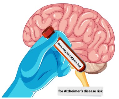Beyin ve beta amiloit test tüpü.