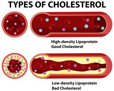 İyi ve kötü kolesterol tiplerinin gösterimi