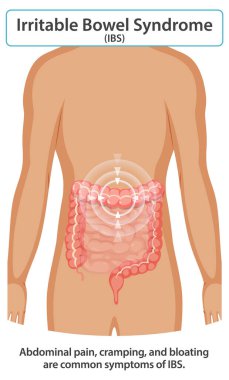 IBS belirtilerinin ve etkilenen bölgelerin gösterimi