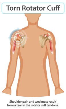 Omuz anatomisi ve yaralanma detayları