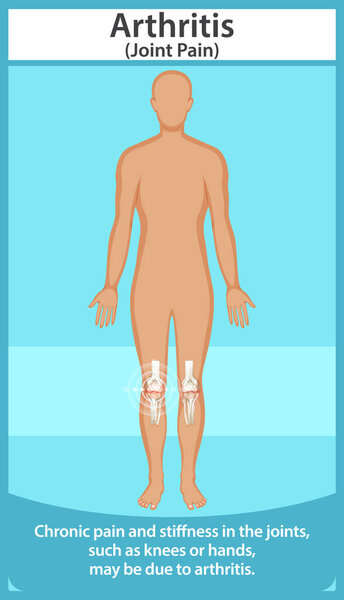 Illustration of arthritis affecting knees and joints