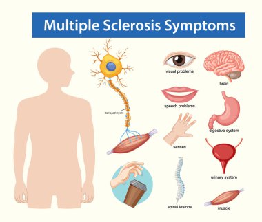 Eğitimsel vektör diyagramı etiketli organlar, sinirler ve vücut sistemlerinde görülen çoklu skleroz semptomlarını temiz, düz bir tıbbi tarzda vurguluyor.