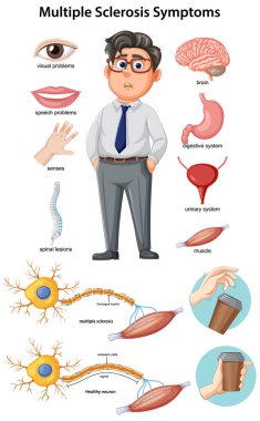 Eğitimsel tıbbi vektör çoklu skleroz belirtileri gösteriyor, etkilenmiş organlar, sinir hasarı ve etiketli diyagramlar ve çizgi film karakterleriyle kas güçsüzlüğü.