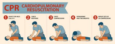 Kalp masajı, göğüs masajı ve acil durum müdahalelerini gösteren adım adım vektör rehberi.