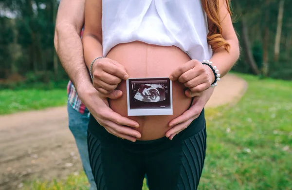 Tanınamayan Latin Bir Kadın Hamile Eşi Karnını Tutarken Bebeğinin Ultrason — Stok fotoğraf