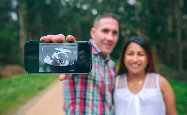 Homem Feliz Mostrando Ultra Som Bebê Celular Lado Sorrir Mulher — Fotografia de Stock
