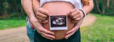 Tanınamayan Latin bir kadın hamile. Eşi karnını tutarken bebeğinin ultrason taramasını gösteriyor.