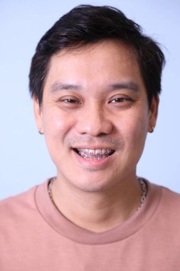 Asyalı diş teli takan, sıradan bir tişört giyen, mavi arka planda gülümseyen bir adam..