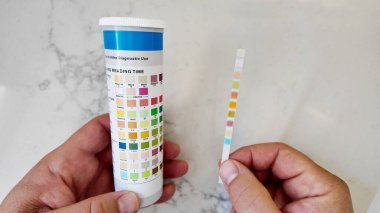Sağlık denetimi için ev idrar testi şeridi