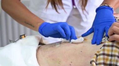 Hastanedeki ameliyattan sonra hemşirelerin elleri karnını temizler ve tedavi eder. Karnında cerrahi bir yara. Yüksek kalite 4k görüntü
