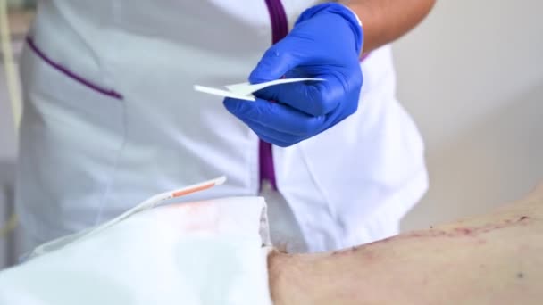 Close Enfermeiros Mão Limpa Trata Lesões Abdominais Após Cirurgia Hospital — Vídeo de Stock