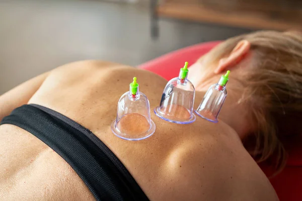 Anonymous woman receiving cupping treatment while lying on stretcher in clinic with row of massage vacuum cups on back