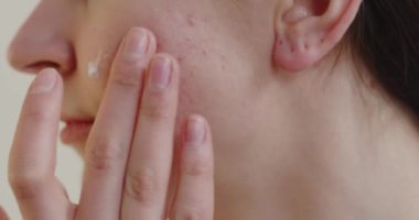 Problem skin. Close up view of the young woman touching acne skin with pores on the face. Dermatology problem concept 