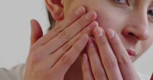 Cropped Shot Young Womans Face Touching Acne Face Pimples Red — Vídeo de stock