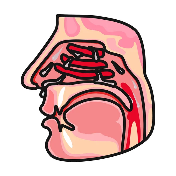 鼻咽矢量图标 白色背景鼻咽分离的彩色矢量标识 — 图库矢量图片