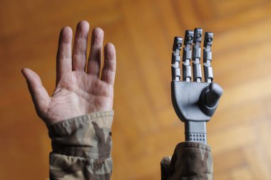 Protez el gösteren engelli bir asker.