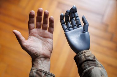 Protez el gösteren engelli bir asker.