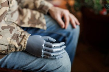 Koltuğunda oturan protez elli bir asker.