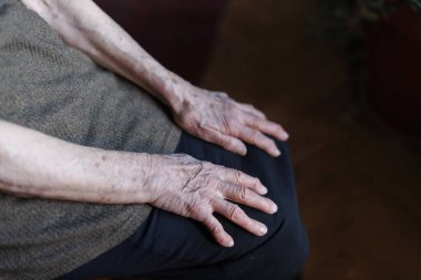 Yaşlı bir kadının elleri kapalı bir ortamda kucakta dinleniyor.