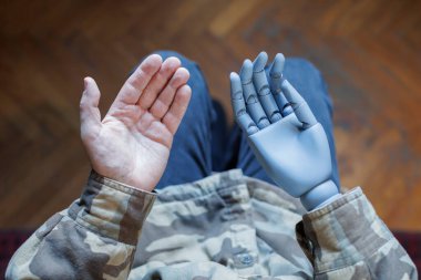 Savaş gazisi elini robotik bir protez elin yanında gösteriyor.