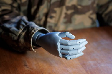 Ordu gazisi protez el gösteriyor.