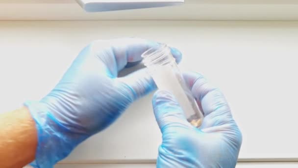 Cerrahın Deney Tüpünün Kapağını Söküp Safra Taşlarını Göstermesine Yakın Durun — Stok video