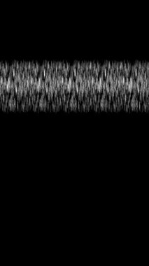 dikey video - Siyah arkaplanda gürültü ile hareket eden çizgilerin 2d canlandırması 