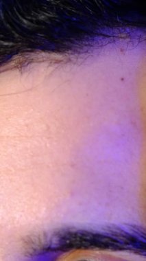 Saç dökülmesini önlemek için kimyasallar enjekte etmek, saç bakımında kullanılan ilaçların uygulanması.