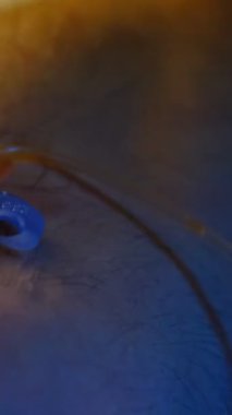 Kan bağışı görüntüsü, damarı açarak uygulanan tedavi, damara enjekte edilen imge.